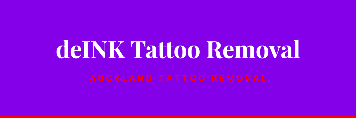deINK Tattoo Removal - tattoo removal in Auckland