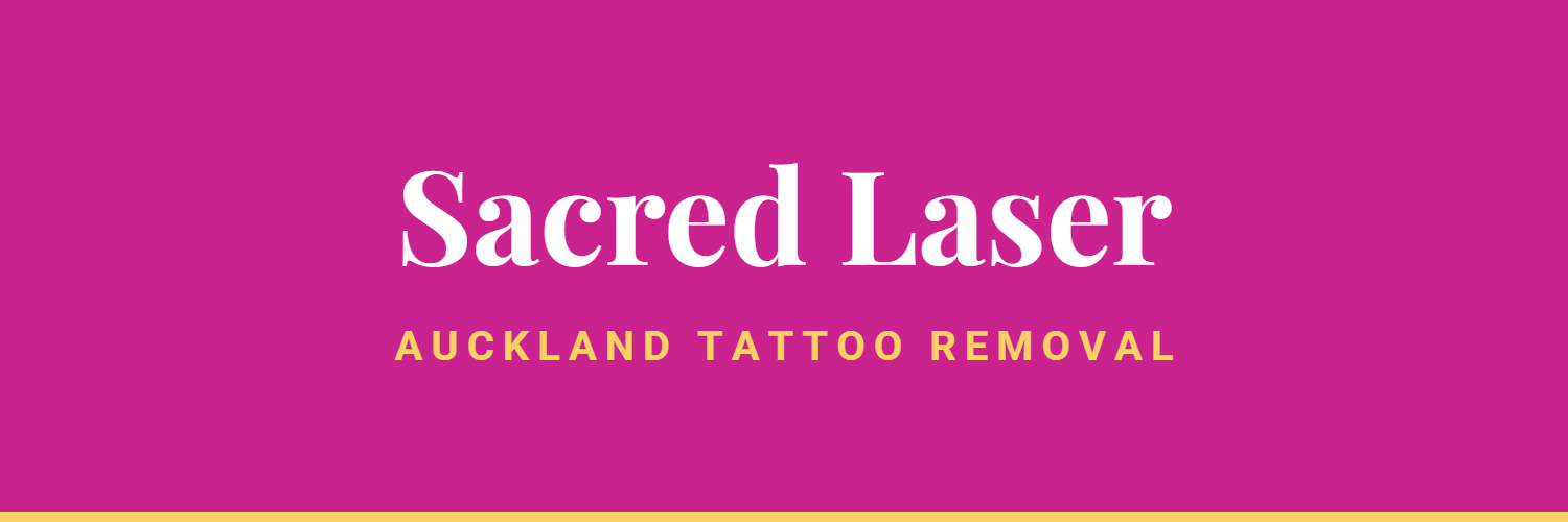 Sacred Laser - tattoo removal in Auckland