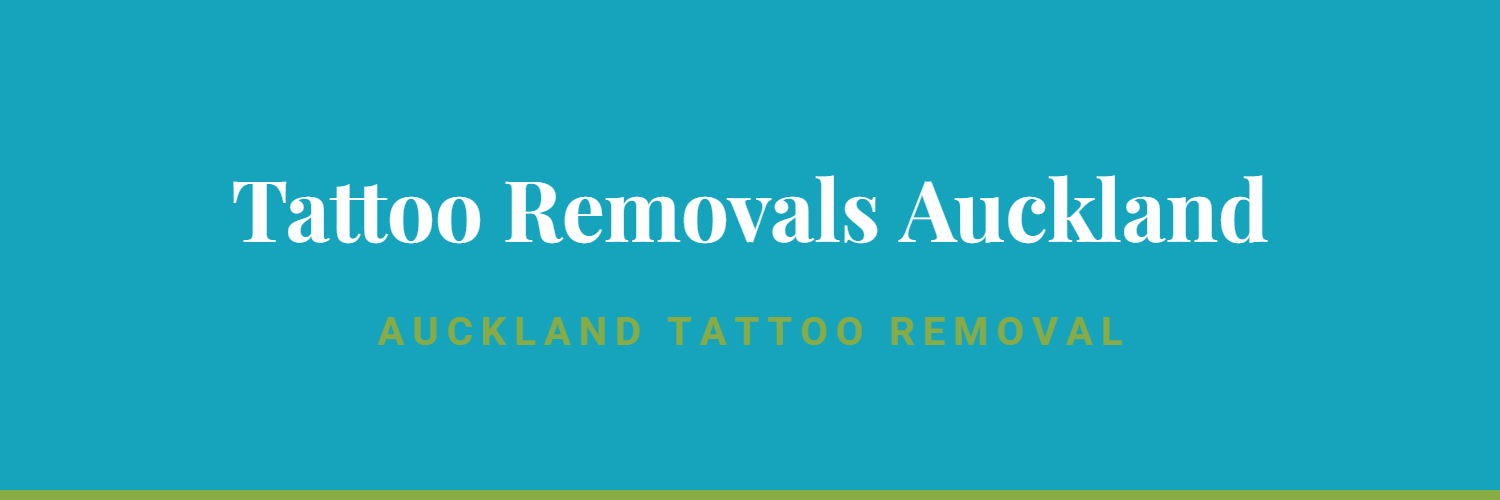 Tattoo Removals Auckland - tattoo removal in Auckland